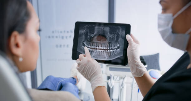 Licensed Teeth Whitening service in Talty, TX - Smile Center Dentistry